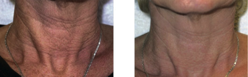 Arcfeszesítés budai kozmetikában online bejelentkezéssel a bwneten