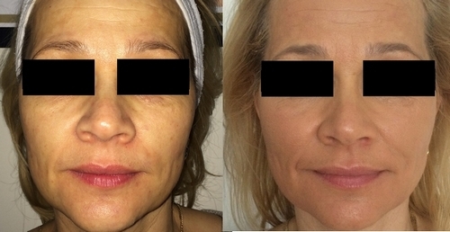 beauty lab szépségszalon budapest online időpontfoglalással