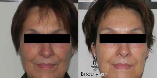 beauty lab szépségszalon budapest online időpontfoglalással