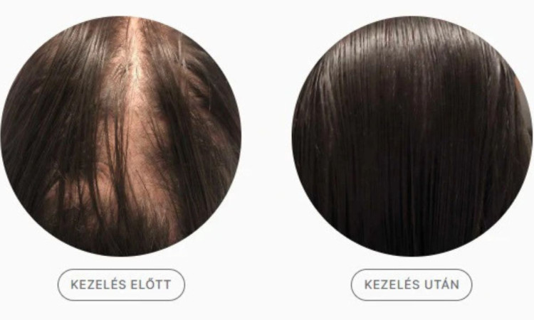 lezeres_hajkezeles_hajhullas_ellen_dus_es_eros_haj lezeres_hajkezeles_hajhullas_ellen_dus_es_eros_haj