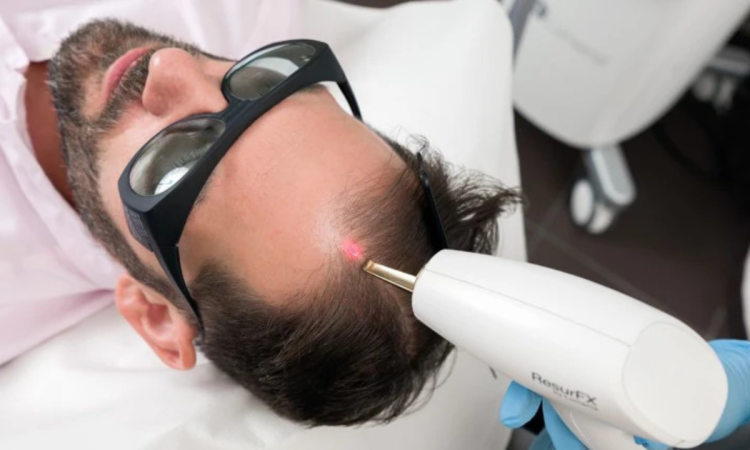 hajuhullas_ellen_a_ferfias_tipusu_hajhullas_okai_es_megoldasai_