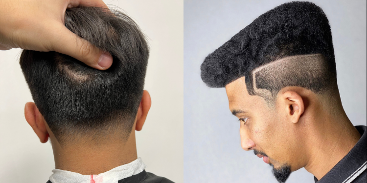 pecs_borbelyuzlet_essential