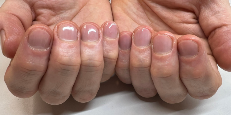 ferfi_manikur_igenyes_ferfias_vonasok ferfi_manikur_igenyes_ferfias_vonasok