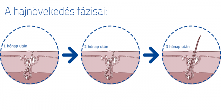 forcapil_hajhullas_elleni_kapszula_mar_a_szepsegszalonokban_is forcapil_hajhullas_elleni_kapszula_mar_a_szepsegszalonokban_is