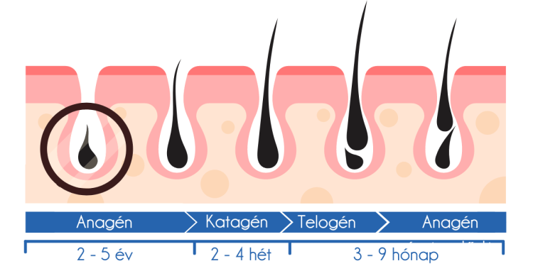 kronikus_hajhullas_okai_es_kezelese kronikus_hajhullas_okai_es_kezelese