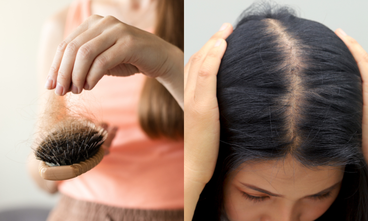 hajhullas_okai_igy_tehetsz_ellene hajhullas_okai_igy_tehetsz_ellene