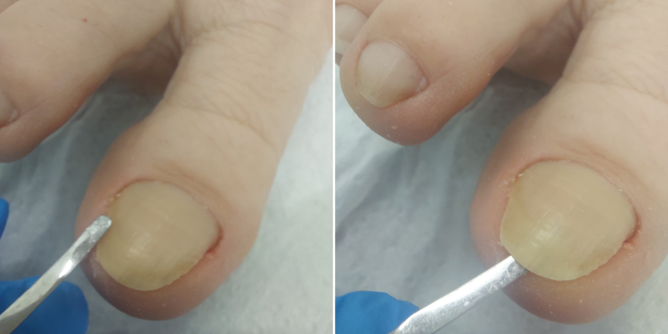 labapolas_vilaga_tanacsok_a_szakembertol labapolas_vilaga_tanacsok_a_szakembertol