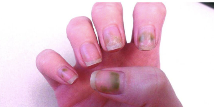 labapolas_vilaga_tanacsok_a_szakembertol labapolas_vilaga_tanacsok_a_szakembertol