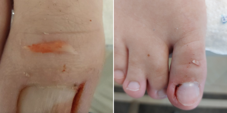 labapolas_vilaga_tanacsok_a_szakembertol labapolas_vilaga_tanacsok_a_szakembertol