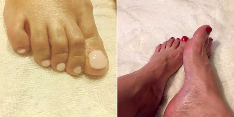 labapolas_vilaga_tanacsok_a_szakembertol labapolas_vilaga_tanacsok_a_szakembertol