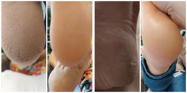 labapolas_vilaga_tanacsok_a_szakembertol labapolas_vilaga_tanacsok_a_szakembertol