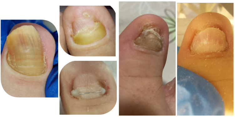 labapolas_vilaga_tanacsok_a_szakembertol labapolas_vilaga_tanacsok_a_szakembertol