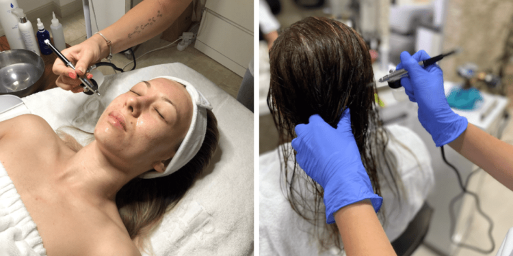 seborrhea_hogyan_ismerheto_fel_es_mi_a_megoldas