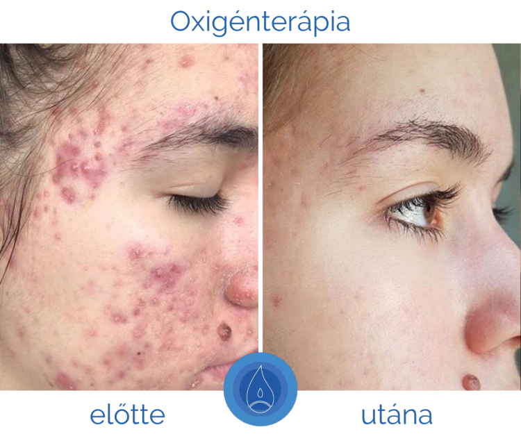 tudatos_borapolas_igy_apold_megfeleloen_a_borod