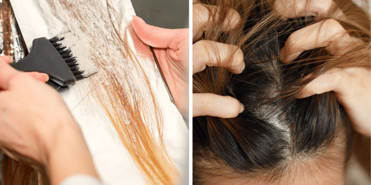 viszketo_fejbor_kialakulasanak_okai_es_kezelese viszketo_fejbor_kialakulasanak_okai_es_kezelese